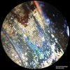 analyth_icd-9.jpg